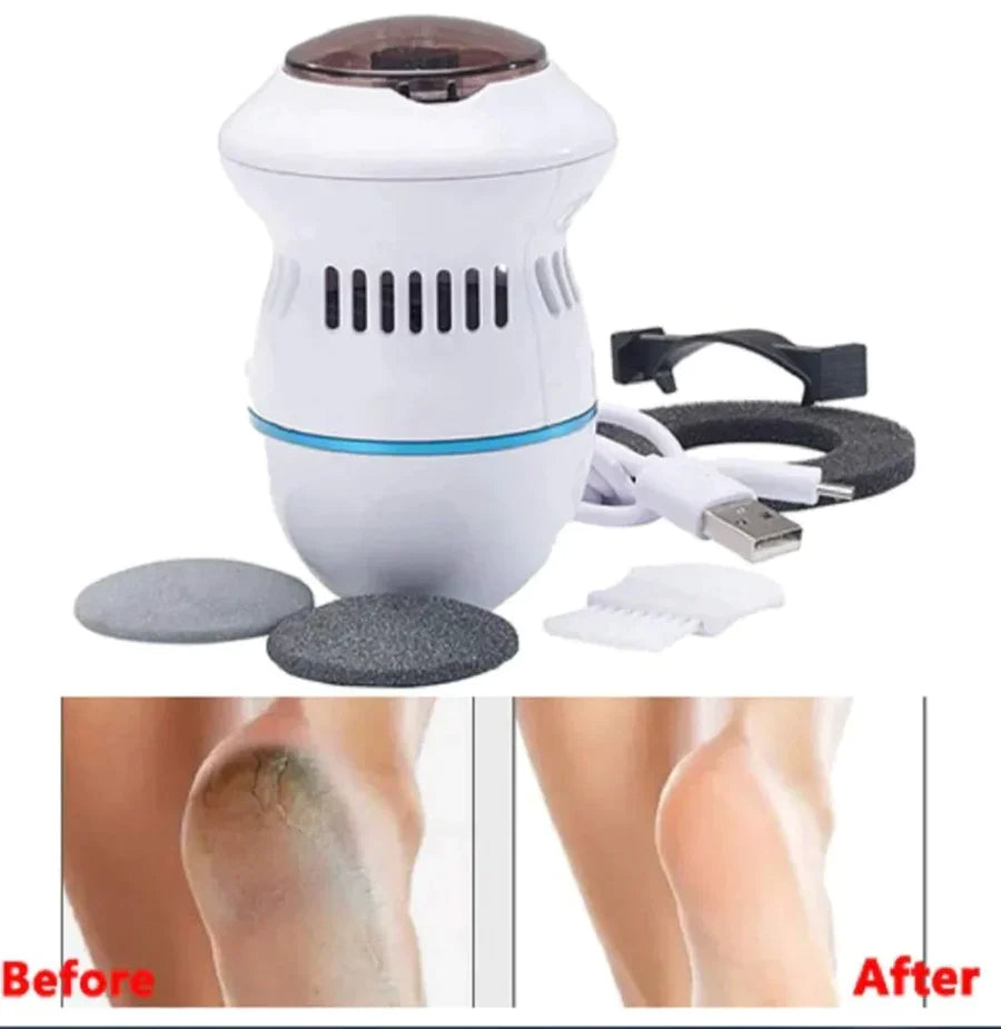 ELECTRIC VACUUM CALLUS REMOVER