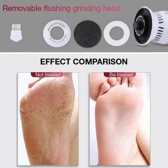 ELECTRIC VACUUM CALLUS REMOVER